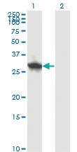 Anti-DCUN1D1 Mouse Monoclonal Antibody [clone: 3D7]