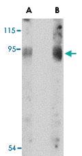 Anti-BICD2 Rabbit Polyclonal Antibody