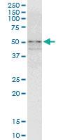 Anti-ZNF296 Mouse Polyclonal Antibody