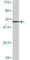 Anti-MPPED2 Mouse Monoclonal Antibody [clone: 2G1-1B7]