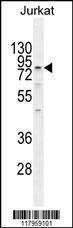 Anti-ELMO2 Rabbit Polyclonal Antibody (FITC (Fluorescein Isothiocyanate))