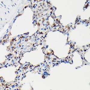 Immunohistochemistry analysis of paraffin-embedded rat lung using Anti-Surfactant Protein A / PSAP Antibody (A11614) at a dilution of 1:50 (40x lens). Perform high pressure antigen retrieval with 10 mM citrate buffer pH 6.0 before commencing with IHC staining protocol.