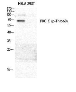 Anti-PKC zeta