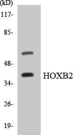 Western blot analysis of the lysates from HUVEC cells using Anti-HOXB2 Antibody