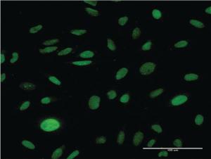 Anti-CMAS Mouse Monoclonal Antibody [clone: 2E1]