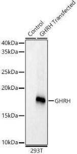 Western blot analysis of 293T-GHRH-his, using Anti-GHRH Antibody [ARC59237] (A309373) at 1:1,000 dilution. The secondary antibody was Goat Anti-Rabbit IgG H&L Antibody (HRP) at 1:10,000 dilution.