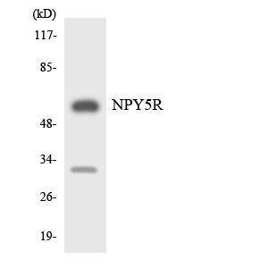 Western blot analysis of the lysates from Jurkat cells using Anti-NPY5R Antibody