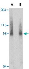 Anti-BICD2 Rabbit Polyclonal Antibody