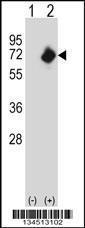 Anti-NMT2 Rabbit Polyclonal Antibody (AP (Alkaline Phosphatase))