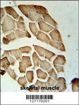 Anti-LDHD Rabbit Polyclonal Antibody (Biotin)