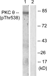 Antibody anti-PKC THET phospho THR538