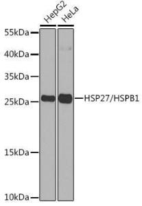 Western blot analysis of extracts of various cell lines, using Anti-Hsp27 Antibody (A307909) at 1:1,000 dilution