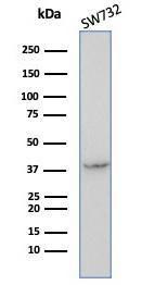 Western blot analysis of SW732 cell line lysate using Anti-Maspin Antibody [SERPINB5/4972]