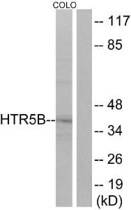 Western blot analysis of lysates from COLO cells using Anti-HTR5B Antibody. The right hand lane represents a negative control, where the antibody is blocked by the immunising peptide.