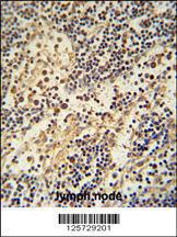 Anti-HEMK1 Rabbit Polyclonal Antibody (AP (Alkaline Phosphatase))