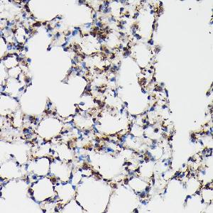 Immunohistochemistry analysis of paraffin-embedded mouse lung using Anti-Surfactant Protein A / PSAP Antibody (A11614) at a dilution of 1:50 (40x lens). Perform high pressure antigen retrieval with 10 mM citrate buffer pH 6.0 before commencing with IHC staining protocol.