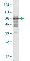 Anti-MPPED2 Mouse Monoclonal Antibody [clone: 4H5]