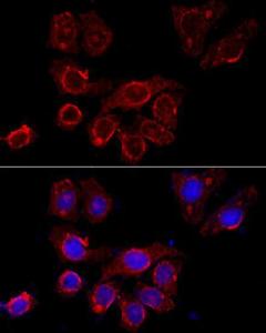 Immunofluorescence analysis of HeLa cells using Anti-CD116 Antibody (A11617) at a dilution of 1:100 (40X lens). DAPI was used to stain the cell nuclei (blue)