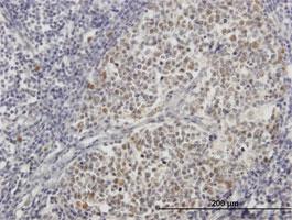 Anti-ZNF296 Mouse Polyclonal Antibody