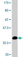 Anti-PRPF4B Mouse Monoclonal Antibody [clone: 3E10]