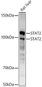 Anti-STAT2 Rabbit Monoclonal Antibody [clone: ARC51796]