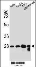 Anti-CHPT1 Rabbit Polyclonal Antibody (HRP (Horseradish Peroxidase))