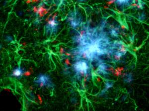 This triple exposure allows for the simultaneous localization of Amylo-Glo® positive amyloid plaques (blue), GFAP positive hypertrophied astrocytes (green) and activated microglia (red) in the hippocampus of the AD/Tg mouse. Combined UV, blue and green light illumination.