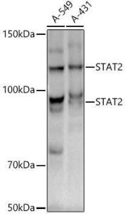 Anti-STAT2 Rabbit Monoclonal Antibody [clone: ARC51796]