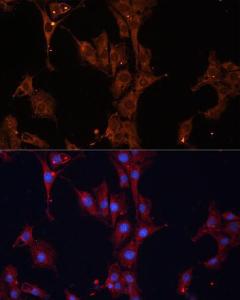 Immunofluorescence analysis of C6 cells using Anti-Hsp27 Antibody (A307909) at a dilution of 1:100. DAPI was used to stain the cell nuclei (blue)