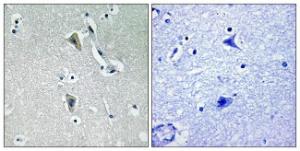 Antibody anti-PKC THET phospho THR538