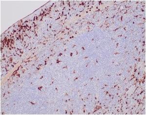 SDS-PAGE analysis of Anti-Lysozyme Antibody [LYZ/3943] under non-reduced and reduced conditions; showing intact IgG and intact heavy and light chains, respectively SDS-PAGE analysis confirms the integrity and purity of the antibody