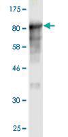 Anti-TKTL1 Mouse Monoclonal Antibody [clone: 1D6]