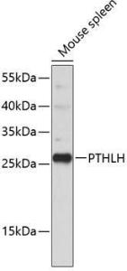 Western blot analysis of extracts of mouse spleen, using Anti-PTHLH Antibody (A11619). The secondary antibody was Goat Anti-Rabbit IgG H&L Antibody (HRP) at 1:10,000 dilution. Lysates/proteins were present at 25µg per lane. The blocking buffer used was 3% non-fat dry milk in TBST.