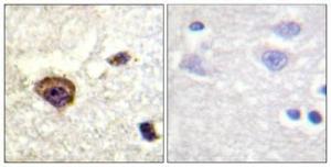 Antibody anti-PKC THET phospho THR538