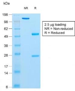 SDS-PAGE analysis of Anti-Insulin Antibody [rIRDN/805] under non-reduced and reduced conditions; showing intact IgG and intact heavy and light chains, respectively SDS-PAGE analysis confirms the integrity and purity of the antibody