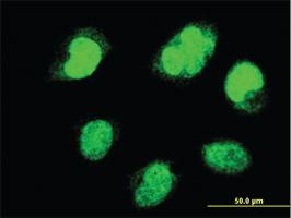 Anti-PAX7 Mouse Monoclonal Antibody [clone: 1G11]