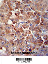 Anti-CHRDL1 Rabbit Polyclonal Antibody