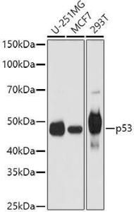 Western blot analysis of extracts of various cell lines, using Anti-p53 Antibody (A11620) at 1:1,000 dilution