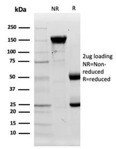 Analysis of protein array containing more than 19,000 full-length human proteins using Anti-Lysozyme Antibody [LYZ/3943] Z-Score and S- Score