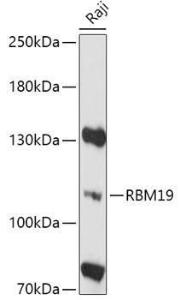 Anti-RBM19 antibody