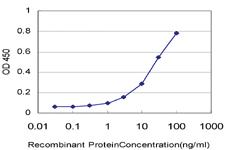 Anti-PAX7 Mouse Monoclonal Antibody [clone: 1G11]