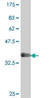 Anti-ITGB3BP Mouse Polyclonal Antibody