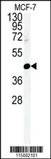 Anti-CENPN Rabbit Polyclonal Antibody