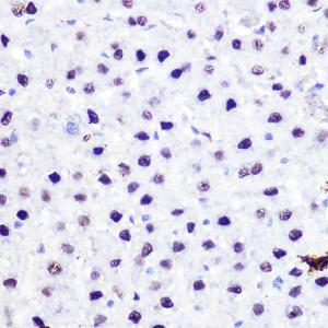 Immunohistochemistry analysis of paraffin-embedded rat liver using Anti-p53 Antibody (A11620) at a dilution of 1:100 (40X lens). Perform microwave antigen retrieval with 10 mM Tris/EDTA buffer pH 9.0 before commencing with IHC staining protocol