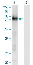 Anti-CD93 Mouse Monoclonal Antibody [clone: 3D12]