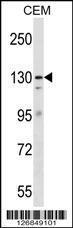 Anti-ERCC5 Rabbit Polyclonal Antibody (APC (Allophycocyanin))