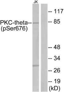 Western blot analysis of lysates from Jurkat cells treated with PMA 200nM 30' using Anti-PKC thet (phospho Ser676) Antibody. The right hand lane represents a negative control, where the antibody is blocked by the immunising peptide.