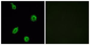 Immunofluorescence analysis of HUVEC cells using Anti-HTR5B Antibody. The right hand panel represents a negative control, where the antibody was pre-incubated with the immunising peptide.