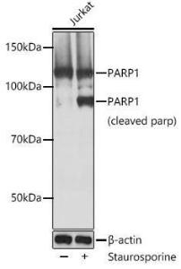 Western blot analysis of extracts of Jurkat cells, using Anti-PARP1 Antibody [ARC0075] (A306436) at 1:1000 dilution. Jurkat cells were treated by Staurosporine(1 µM) at room temperature for 3 hours. The secondary Antibody was Goat Anti-Rabbit IgG H&L Antibody (HRP) at 1:10000 dilution