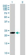 Anti-BIN3 Mouse Polyclonal Antibody